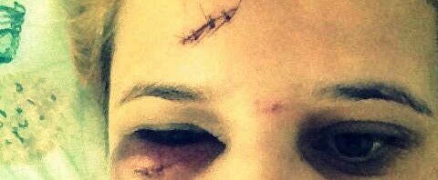 Der Angriff gegen Ana Paula Araujo